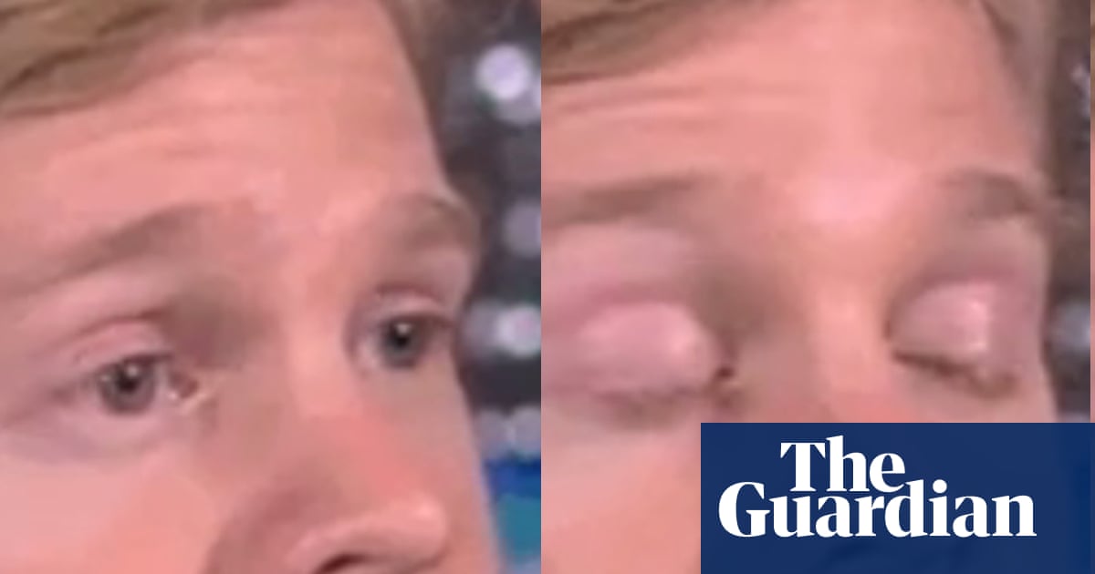 Man who became popular in Blinking White Guy gif raises over $300,000 for multiple sclerosis research