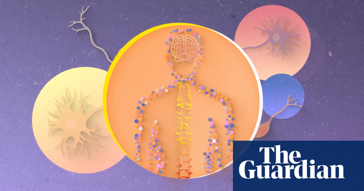 Sufferers of chronic pain have long been told it’s all in their head. We now know that’s wrong