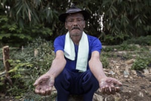 Oha, 70, is covered with dermatitis. He lives a few metres from the Citarum River and for 36 years collected the grass nearby to feed his goats. He is using a cortisone cream and has been under treatment for three years. He has been visited 25 times by eight doctors but, unable to move away from the river, he cannot heal.