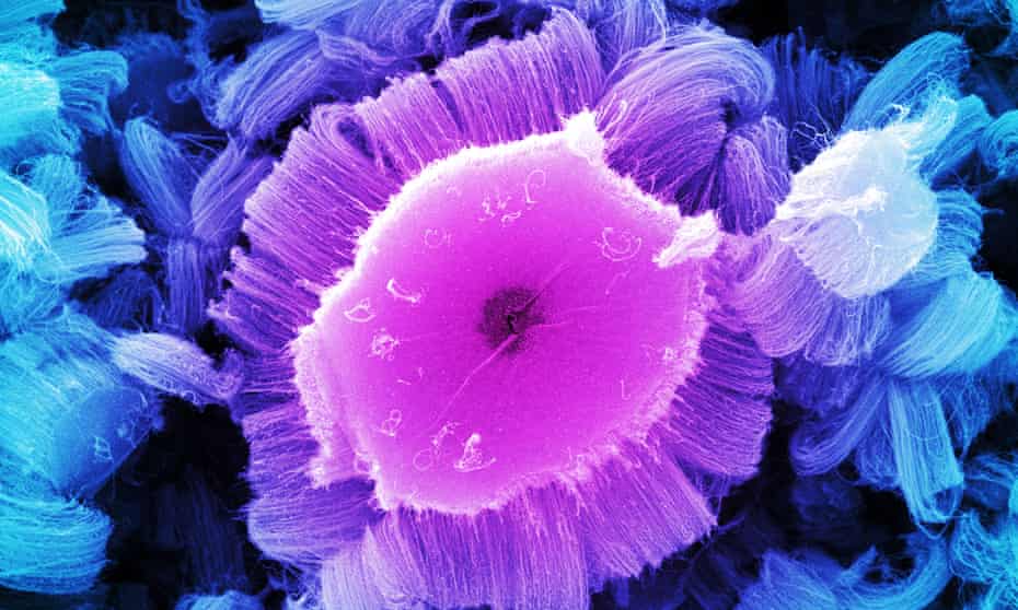A highly magnified view of a nanoparticle, coloured  magenta in the photo