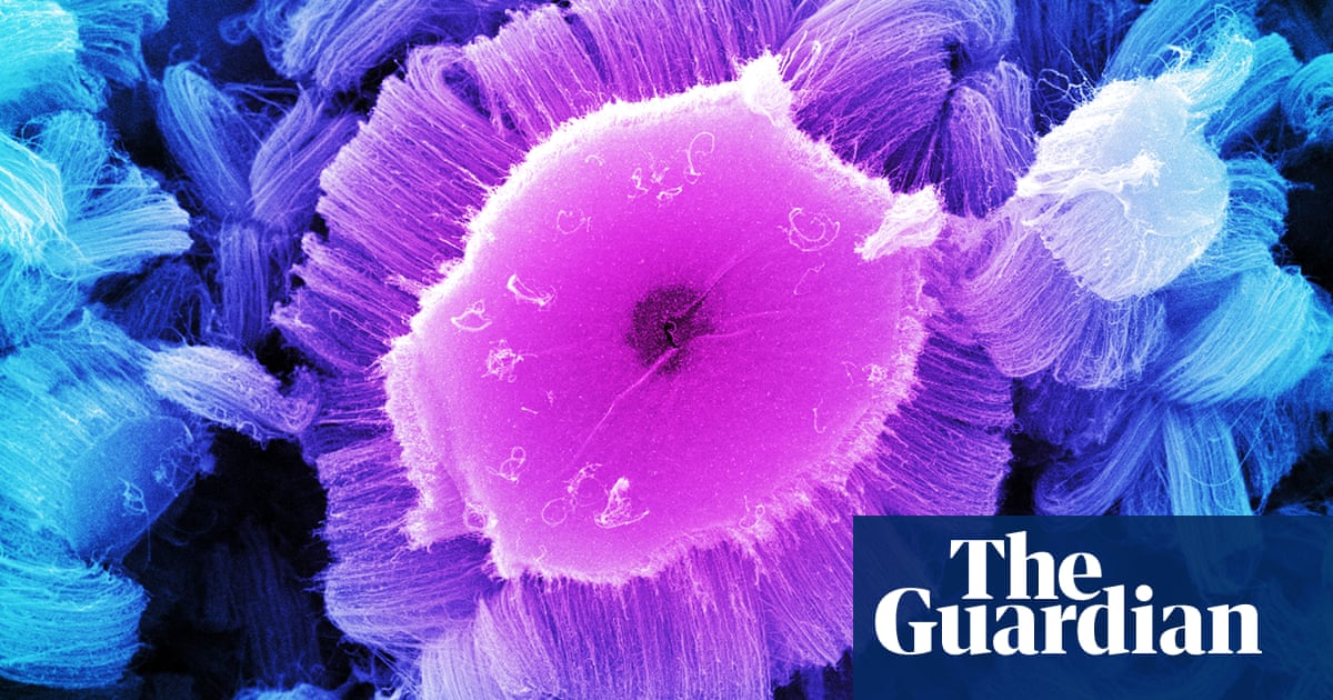Top cancer experts being put off UK by politicians' messaging on immigration'