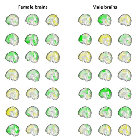 The volumes (green = large, yellow = small) of brain regions in 42 adults, showing the overlap between the forms that brains of females and brains of males can take.