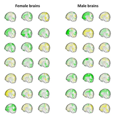 Brain Mars Men are from Mars, women are from Venus? New brain study says not ...