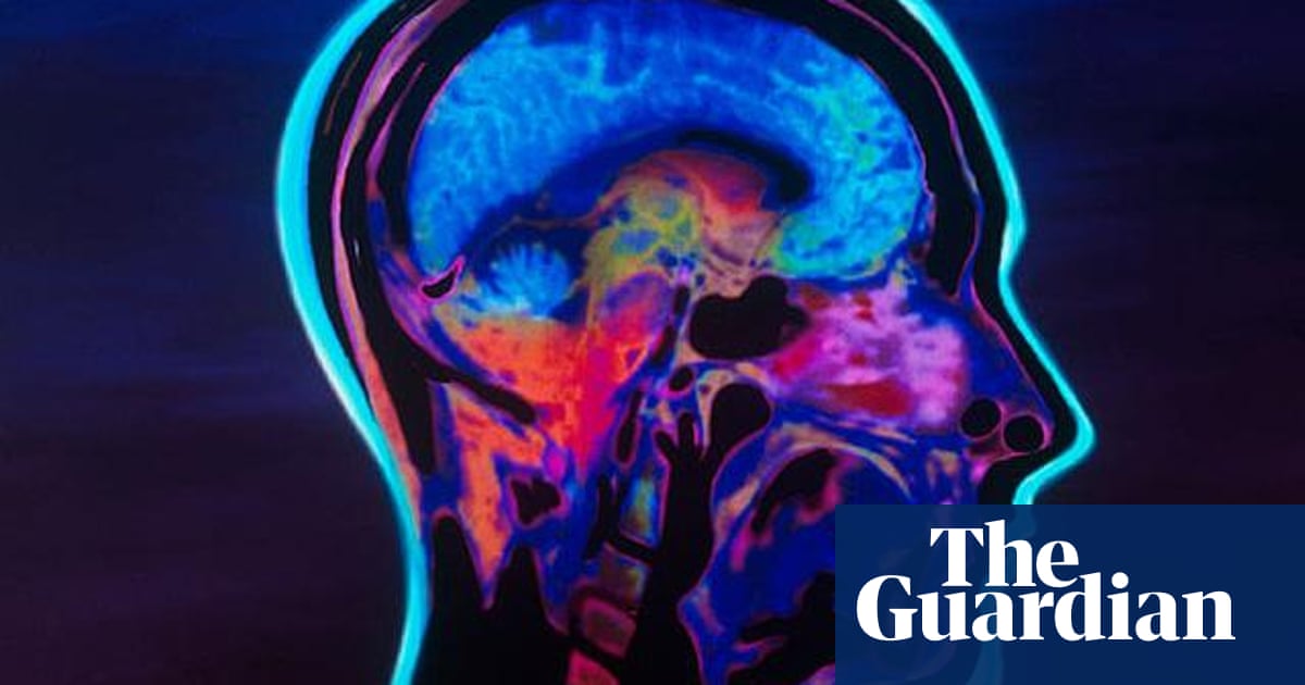Misinterpreting Growth Mindset Why Were >> New Test For Growth Mindset The Theory That Anyone Who Tries Can Misinterpreting Growth Mindset Why Were >> New Test For Growth Mindset The Theory That Anyone Who Tries Can