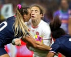Pioneering study aims to find out how repeated blows to head in women’s rugby affects brain