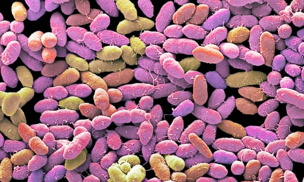 Scanning electron micrograph (SEM) of bacteria cultured from a sample of human faeces. 