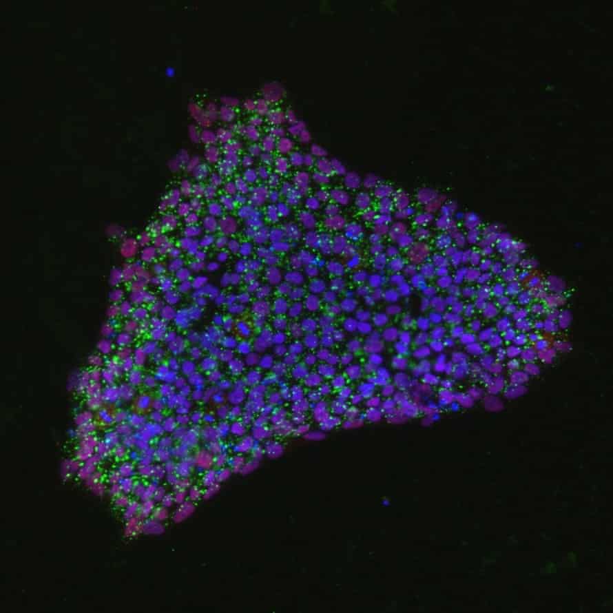 Induced stem cells labelled with fluorescent tags.
