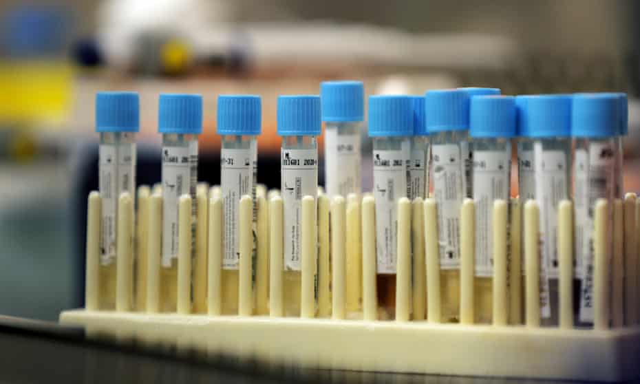 Vials with samples taken for the new coronavirus are seen before they are prepared for RNA testing at the molecular pathology lab at Tulane University School of Medicine in New Orleans. 
