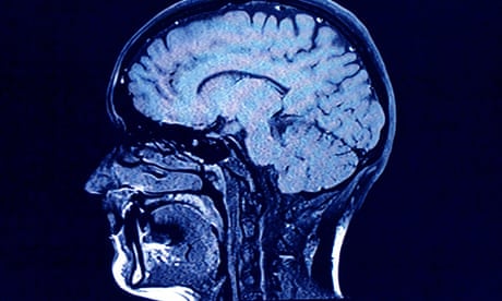 Brain head scan