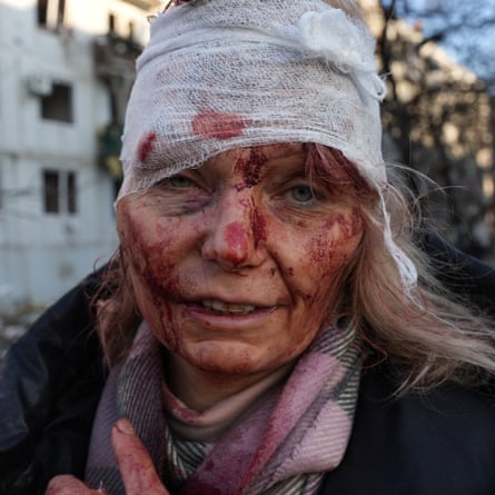 A wounded woman with a bandage around her head