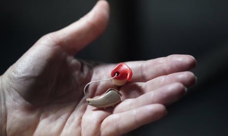 Hearing aids without a prescription could be just as helpful in
