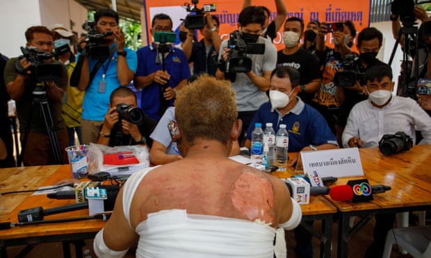 Chalit Chotisupakarn, who survived the fire at Mountain B nightclub, talks to reporters.