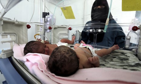 A doctor attends to newborn twins at a therapeutic feeding centre in a hospital in Sana’a, Yemen