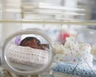 Disparità nell'assistenza sanitaria neonatale: i bambini nati da madri nere hanno un rischio dell'81% più alto di morte nelle cure neonatali in Inghilterra e Galles
Approfondimento
Uno studio recente condotto dall'Università di Liverpool ha analizzato i dati su oltre 700.000 bambini ammessi a un'unità neonatale dell'NHS in Inghilterra e Galles tra il 2012 e il 2022, evidenziando disparità significative nell'assistenza sanitaria neonatale. I risultati hanno mostrato che i bambini nati da madri nere hanno un rischio dell'81% più alto di morire nelle cure neonatali rispetto ai bambini nati da madri bianche.
Possibili Conseguenze
Le scoperte dello studio potrebbero avere un impatto significativo sulla politica sanitaria e sulla pianificazione delle cure neonatali, con l'obiettivo di ridurre la mortalità neonatale e migliorare i risultati sanitari per tutti i bambini. È fondamentale che i responsabili delle politiche sanitarie e i professionisti della salute prendano seriamente in considerazione le disparità nell'assistenza sanitaria neonatale e lavorino per ridurre le differenze nei risultati sanitari.
Opinione
È cruciale che i responsabili delle politiche sanitarie e i professionisti della salute riconoscano l'importanza di affrontare le disparità nell'assistenza sanitaria neonatale e lavorino per creare un sistema di cure più equo e accessibile per tutti. Ciò richiederà un impegno a lungo termine per ridurre le barriere culturali, sociali ed economiche che contribuiscono a queste disparità.
Analisi Critica dei Fatti
Lo studio fornisce una visione critica delle disparità nell'assistenza sanitaria neonatale, evidenziando la necessità di un'azione immediata per affrontare le cause profonde di queste differenze. I risultati dello studio suggeriscono che le disparità nell'assistenza sanitaria neonatale sono complesse e multifattoriali, e richiedono un approccio olistico per essere affrontate.
Relazioni con altri fatti
Le scoperte dello studio sono coerenti con altre ricerche che hanno evidenziato le disparità nell'assistenza sanitaria e nei risultati sanitari per le popolazioni svantaggiate. Ad esempio, studi precedenti hanno mostrato che le donne nere hanno un rischio più alto di morte materna e che i bambini nati da madri nere hanno un rischio più alto di morte infantile.
Contesto storico
Lo studio si inserisce nel contesto di una più ampia discussione sulla disuguaglianza nell'assistenza sanitaria e sulla necessità di interventi mirati per ridurre le disparità nei risultati sanitari. La disuguaglianza nell'assistenza sanitaria è un problema persistente in molti paesi, e richiede un impegno a lungo termine per essere affrontata.
Fonti
Lo studio è stato condotto dall'Università di Liverpool e i risultati sono stati pubblicati sul sito The Guardian. La fonte originale dell'articolo è The Guardian, e il link diretto all'articolo è https://www.theguardian.com/world/2025/nov/04/babies-born-to-black-mothers-81-more-likely-to-die-in-neonatal-care-nhs-study-shows.