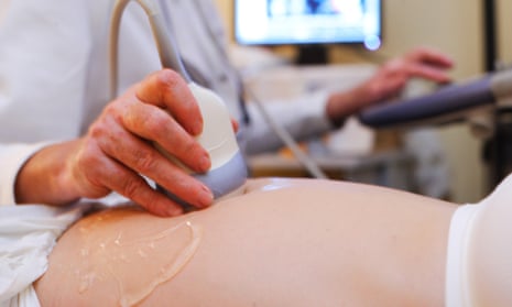 Pregnant woman undergoing an obstetrical ultrasound scan