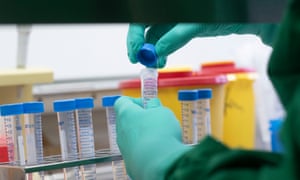 Coronavirus test samples in a lab