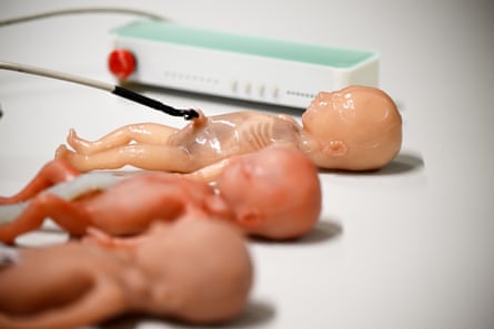 Replica premature babies.