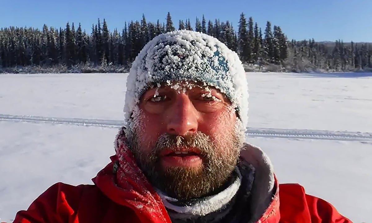 Briton Mails Severed Toes To Canada For Use In Notorious Cocktail