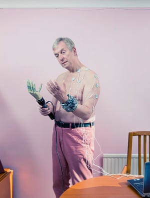 UntitledDavid Vintiner: ‘Professor Kevin Warwick, one of the worlds first cyborgs, implanted a chip into his arm allowing him to control a bionic hand using his nervous system’