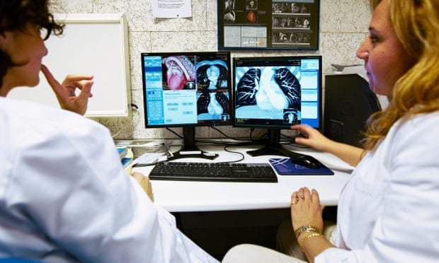 clinicians examine multiple chest scans at a hospital in san sebastian in the basque region of spain