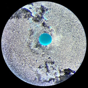 Dental pulp stem cells, looking like a moon with a blue dot. The vibrant blue sphere specifically illuminates the cartilage-like matrix these cells have formed, confirming successful chondrogenesis.
