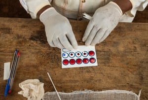 Blood on the paper slide