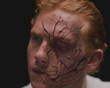 A man's face covered in veins