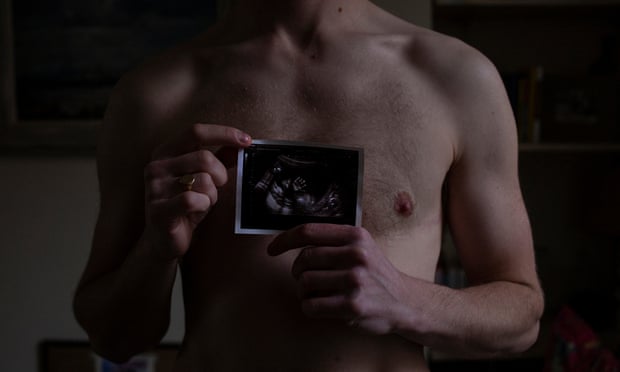 In a still from the documentary Seahorse, Freddy McConnell shows a scan of the baby he is carrying.