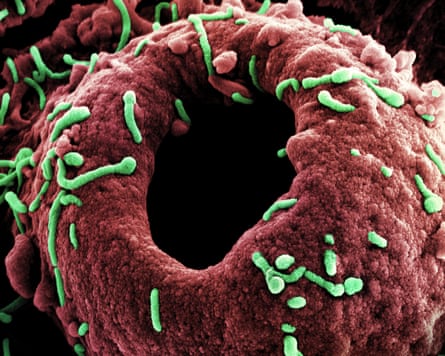 Colourised picture of green viruses attached to a red cell with a hole in the middle