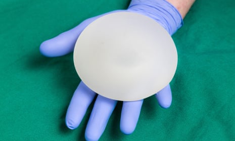 A breast implant.