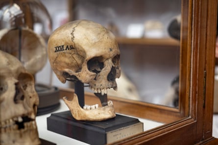 A skull labelled with Latin numerals in a glass case