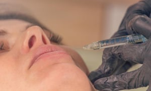 A lip filler procedure.