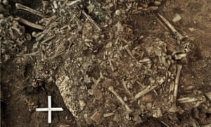 The oldest strain of the plague was found in the teeth of a 20-year-old woman