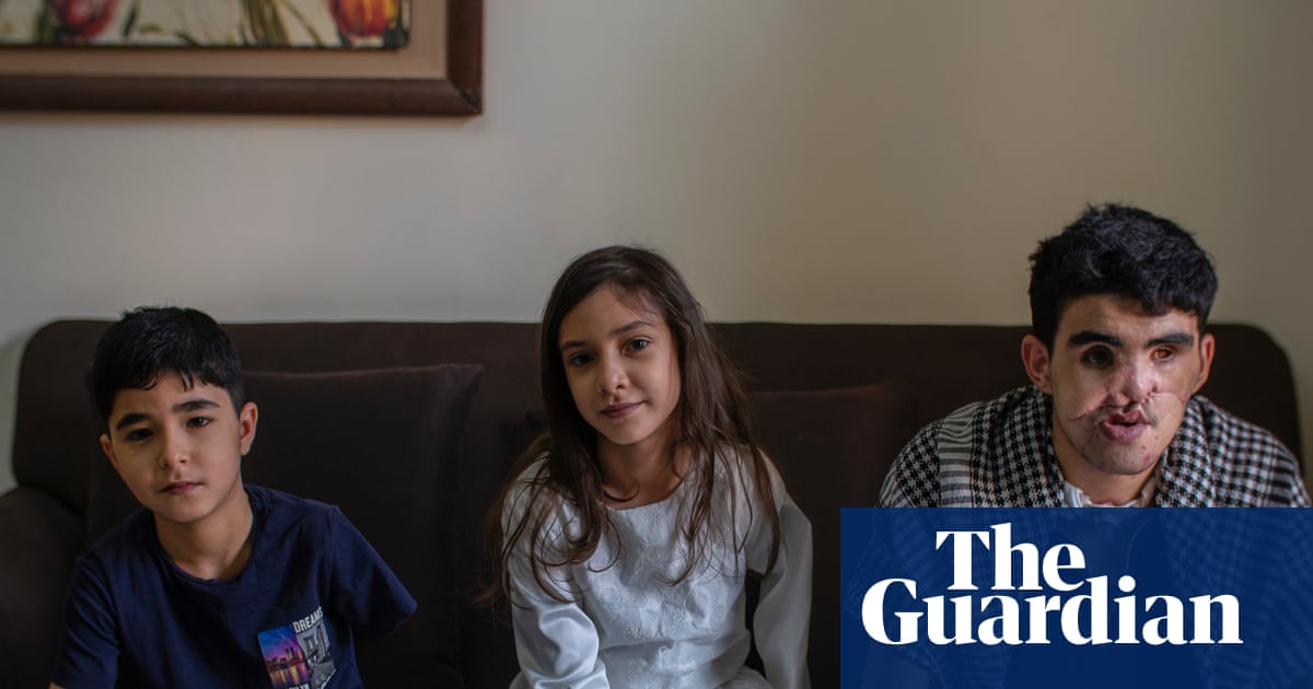 ‘We pray a visa comes before death’: Gaza’s injured children left in limbo