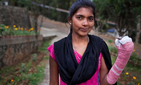 The harder you look the more you find': Nepal's hidden leprosy | Global  health | The Guardian