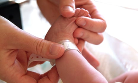 An ID band is placed around a baby's ankle