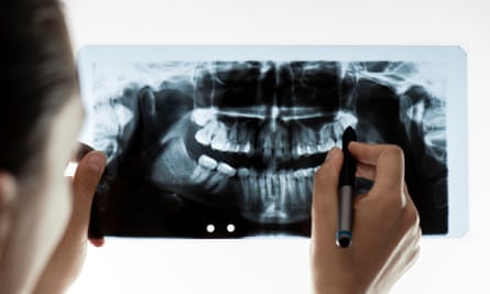 ‘It’s more expensive to bring kids in and remove their teeth in hospital than it is to provide basic dentistry services.’