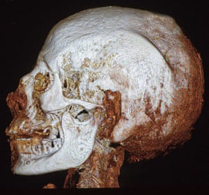 A CT scan of the mummy’s head