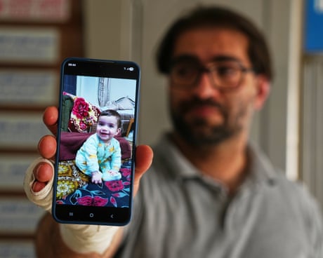 Fahd Abu Haikal with bandaged hand holds a phone showing a photo of his baby Sam