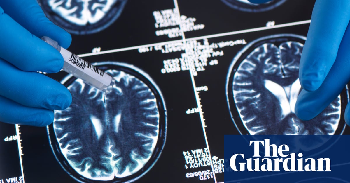 Brain tumour diagnosis could be made within hours, say researchers