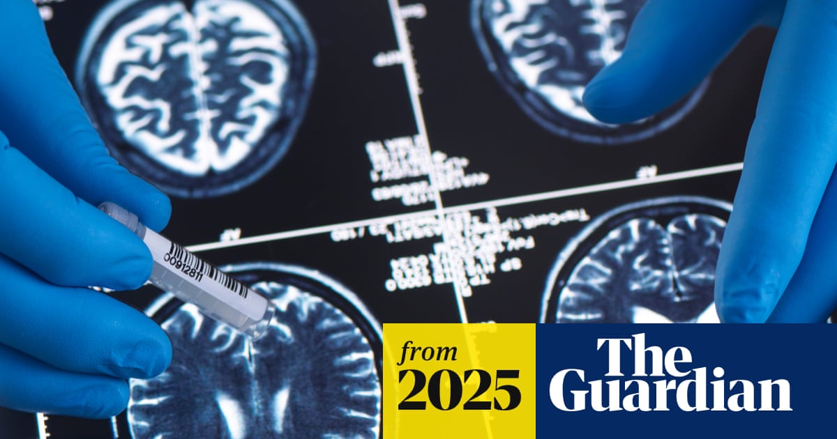 Younger generations less likely to have dementia, study suggests