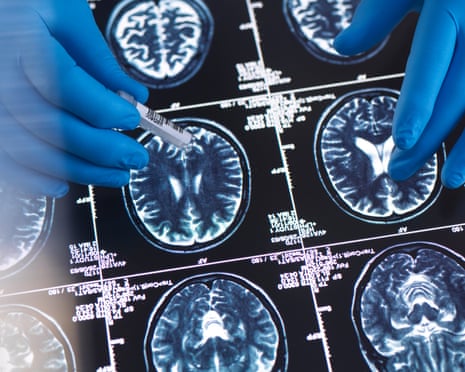 Scientist viewing an MRI (magnetic resonance imaging) scan of the brain whilst holding a sample during an experiment in the lab.