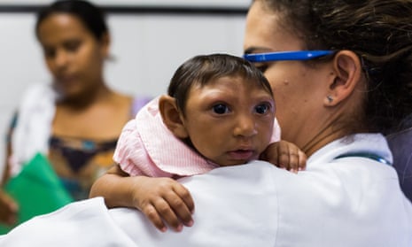 A baby born in Recife, Brazil, earlier this year, suffering from microcephaly. 