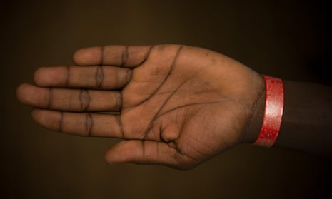 A coloured wristband on the arm of an asylum seeker, which indicates that they are entitled to meals at Lynx House.