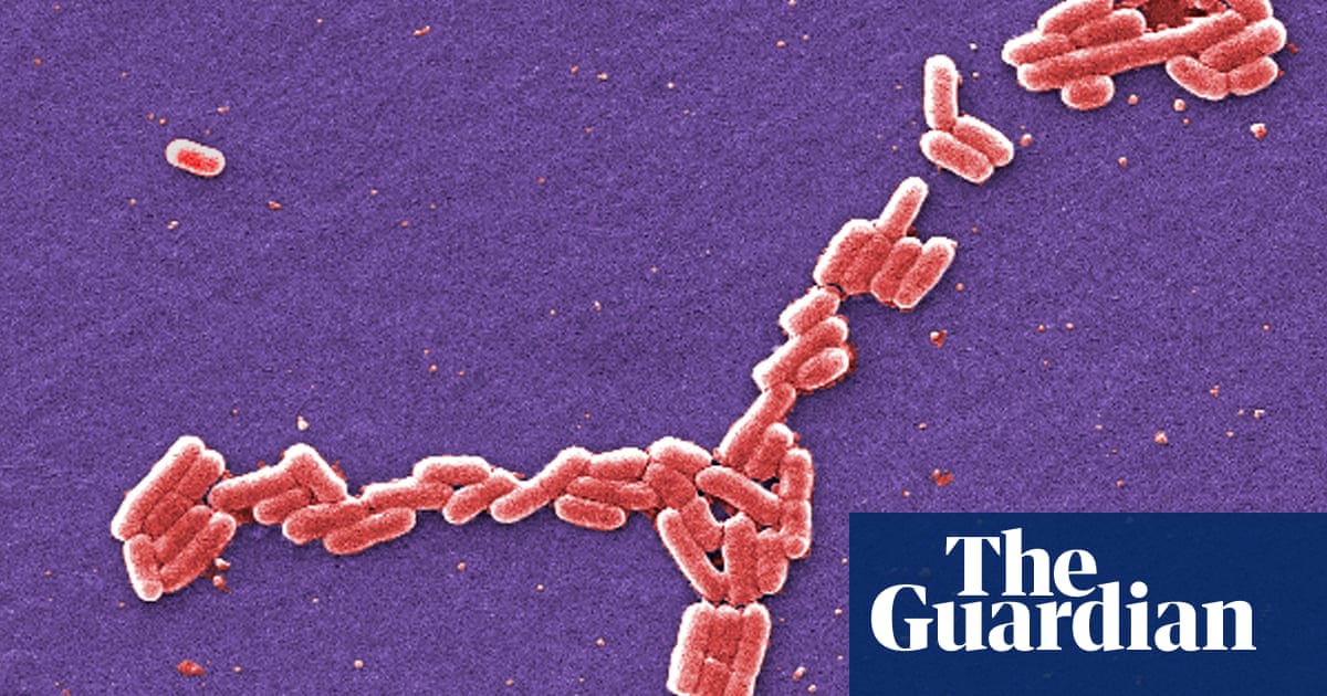  Person dies in Scotland after UK E coli outbreak, health officials say 