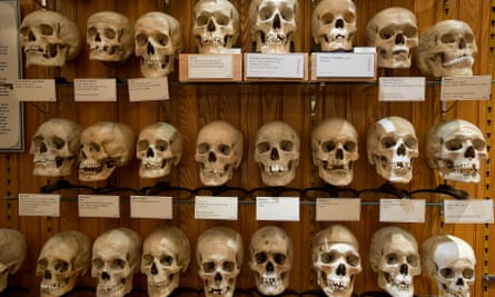 The Hyrtl Skull Collection on display at the museum.