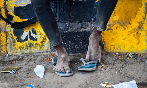 the feet of a migrant worker