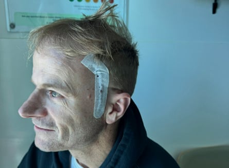 Richard Scolyer says 'prognosis is poor' after brain cancer returns and surgery unsuccessful | Australia news | The Guardian