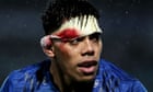 Concussion kingpin resigns global post over plagiarism scandal