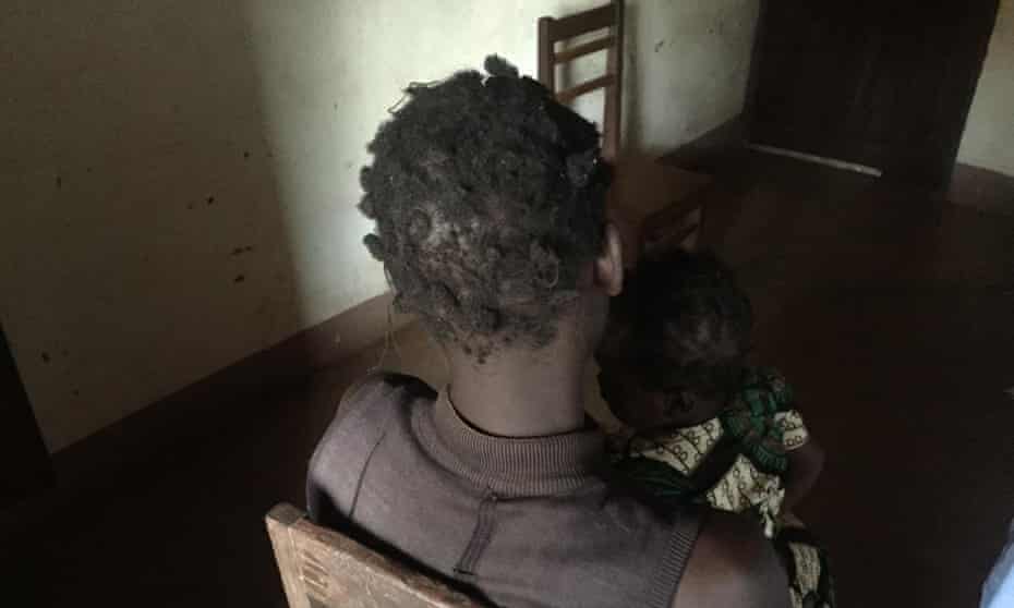 A woman holds her two-year-old daughter, fathered by a Ugandan soldier